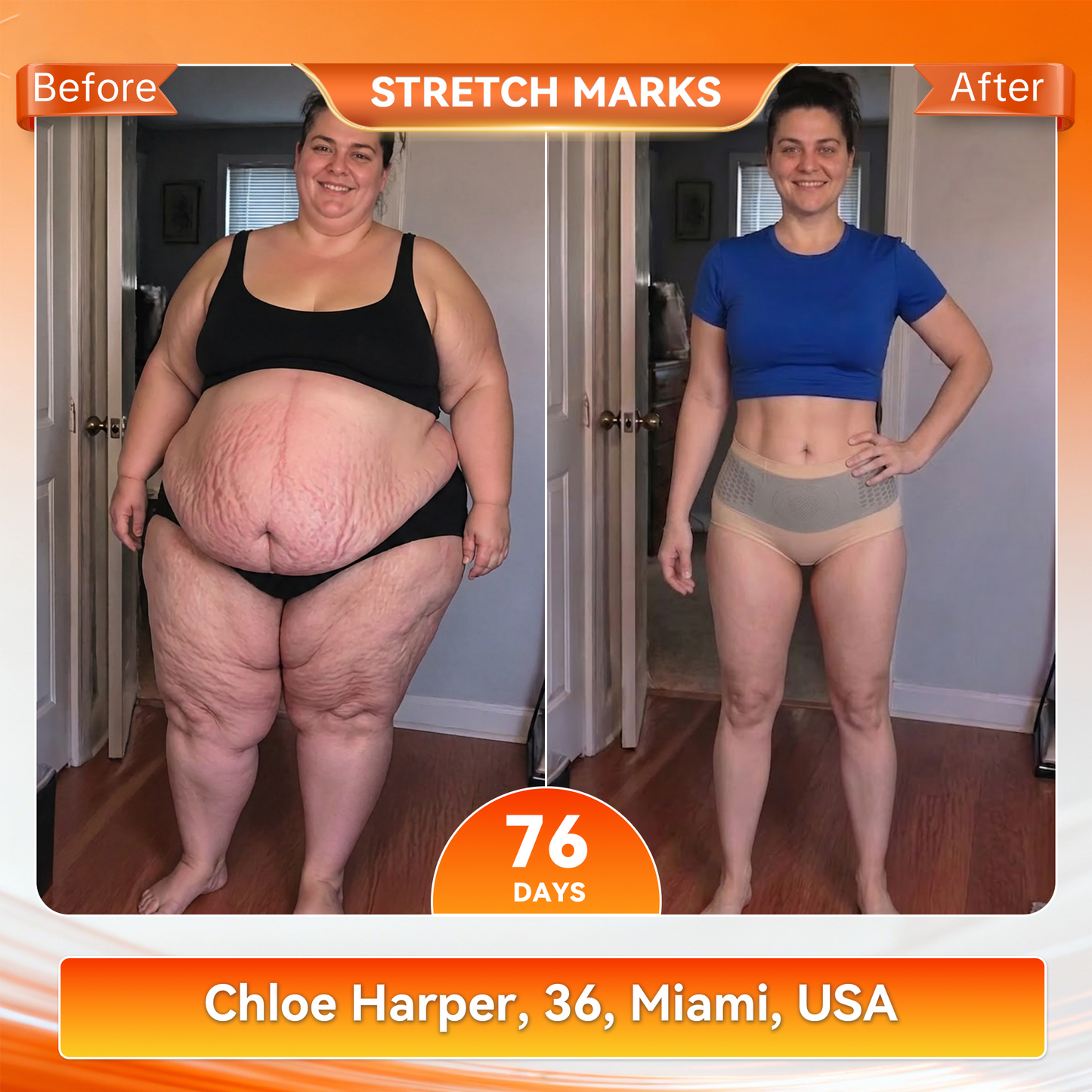 2026 6-in-1 Micro-Particle Sculpting & Fat-Burning Shorts for Women & Men with Male Vitality Support | Moringa × Berberine × NAD+