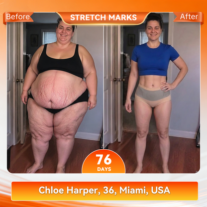 2026 6-in-1 Micro-Particle Sculpting & Fat-Burning Shorts for Women & Men with Male Vitality Support | Moringa × Berberine × NAD+