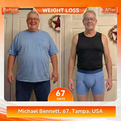 2026 6-in-1 Micro-Particle Sculpting & Fat-Burning Shorts for Women & Men with Male Vitality Support | Moringa × Berberine × NAD+